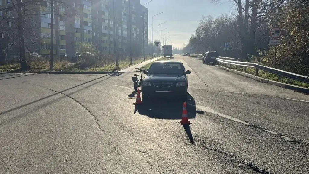 В Кирове Hyundai Accent наехал на женщину на электросамокате